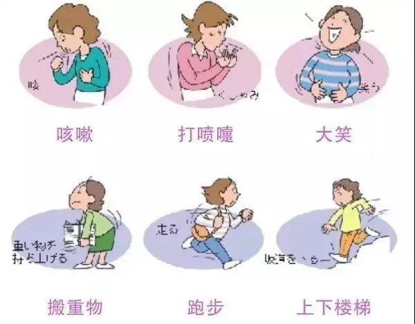 成都产后漏尿 成都产后漏尿