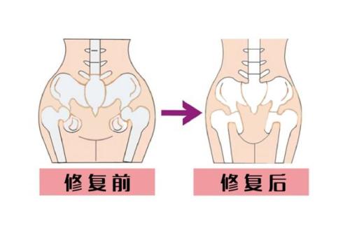 �ɶ����踴��